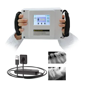 Высокочастотная преносима рентгенова камера с LCD екран Цената на Преносима рентгенова камера Стоматологичен помещение X Ray с senosr размер на 2